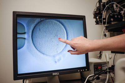 Could Fewer Periods Mean More Fertility? Scientists Explore Whether Slowing Ovulation Could Protect Women's Egg Supply