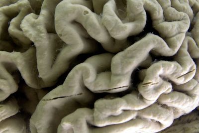 Simple blood test to detect Alzheimers long before memory loss has been developed by scientists