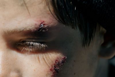 Polish Man Allegedly Attacks 'Ukrainian' Speaker Who Turned Out to Be Fellow Pole