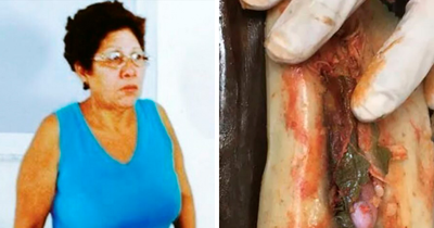 Women Seemed To Offer Ordinary Meals, But Horrific Crimes Uncovered The Dark Reality Of What People Were Eating