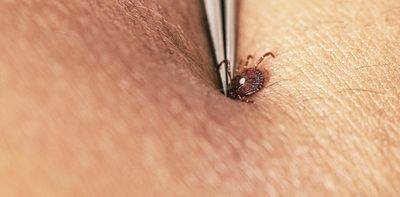 How to avoid tick bites in your yard or while hiking in the woods, and what to do if one starts feasting on you