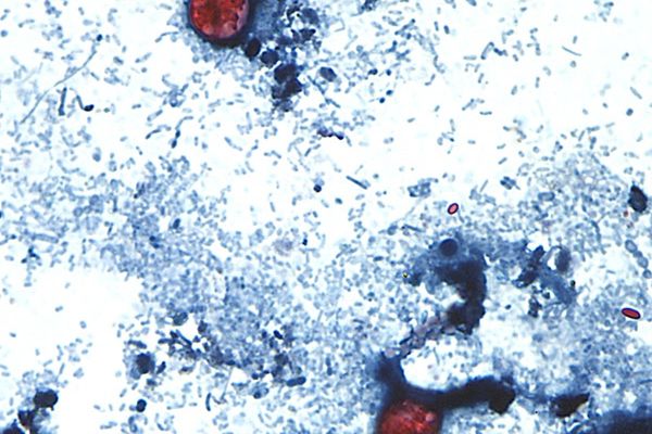 CDC investigating 7,000 cases of ‘explosive diarrhea’ parasite with officials still trying to find the cause