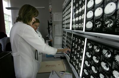 The Alzheimer's Protein Long Blamed for Dementia May Actually Be Critical for Memory, Scientists Find
