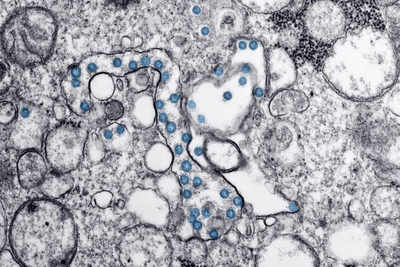 What Is Cyclosporiasis? Taylor Farms and Taco Bell Outbreak Leaves Diners Asking About Symptoms and Risk