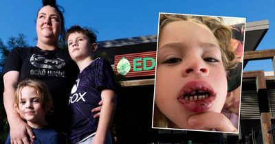 Smashed teeth and an unplanned haircut: mum's horror at closed childcare centre