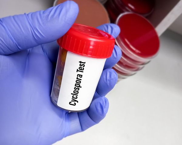 Trump’s deep public health cuts hinder response to record US cyclosporiasis outbreak