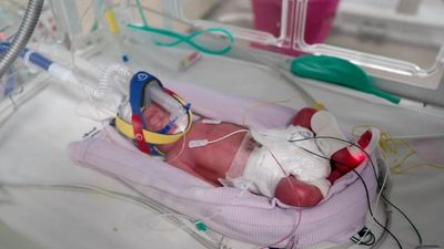 One in 15 million: mum delivers rare quadruplets