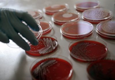 FDA Investigating Growing Salmonella Oranienburg Outbreak with No Source Identified Yet