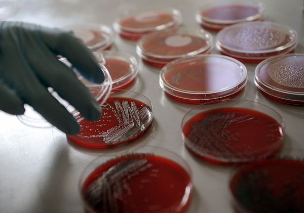 FDA Investigating Growing Salmonella Oranienburg Outbreak with No Source Identified Yet
