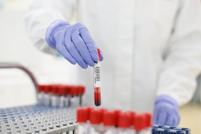 Groundbreaking blood test could detect ‘debilitating’ disease 10 years before symptoms emerge