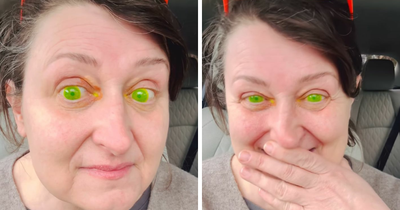 Woman Horrified After Her Pupils Turn Fluorescent Green During Routine Eye Exam, Experts Explain What Happened