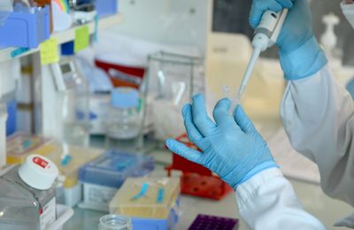 FDA Expands CRISPR Gene Therapy Casgevy to Children as Young as 2 with Sickle Cell Disease