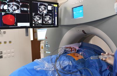 Getting a Better Mix: Recognizing the Potential Risk Factors of Kidney Failure Before It's Too Late