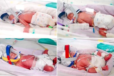 Woman defies the odds and gives birth to rare identical quadruplets in ‘one in 15 million’ pregnancy