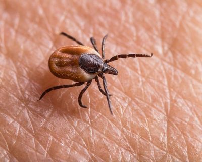 Tick bites are on the rise in the US and UK. Here’s how to protect yourself