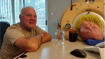 A six-year-old entered an iron lung after polio. More than 70 years later, he had become the world’s longest-known survivor