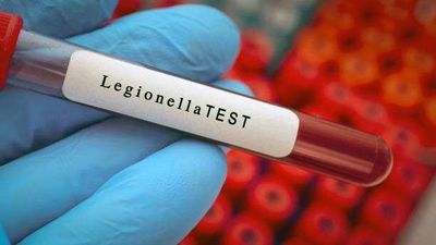 Legionnaires' disease outbreak in NYC kills 5: How dangerous Legionella bacteria multiply in ACs and cooling towers, symptoms, prevention and treatment explained