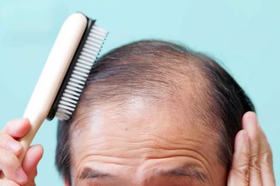 Weight loss drugs linked to loss of hair in major new study