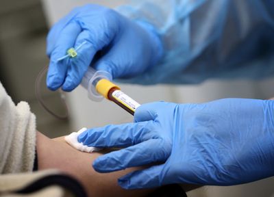 A Blood Test for Colorectal Cancer Is Now Included in Official Screening Guidelines, with Key Limitations Patients Should Know
