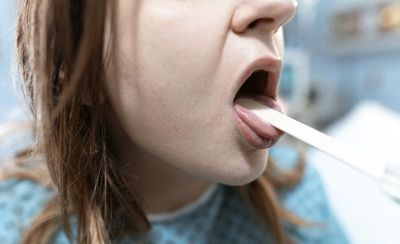 10 Tongue Changes Doctors Say You Shouldn’t Ignore