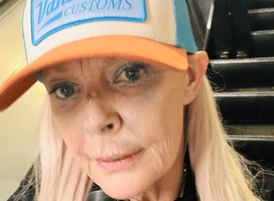Gail Porter reveals badly bruised face after getting 'knocked over' in London Tube station