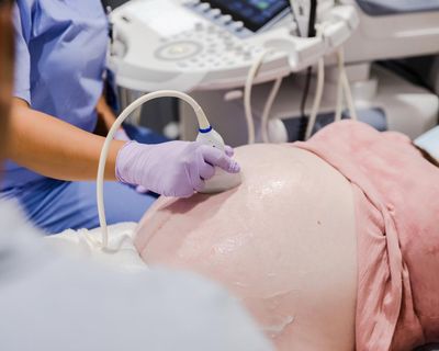 ‘Forever chemicals’ linked to gut inflammation in children after early exposure