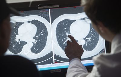 Scientists Apply Evolution Theory to Cancer Treatment, and Timed Drug Switching Could Beat Resistance
