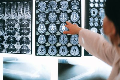A New Glioblastoma Research Finding Highlights an Older Problem: Rural Brain Cancer Patients Often Can't Access the Care That Would Help Them