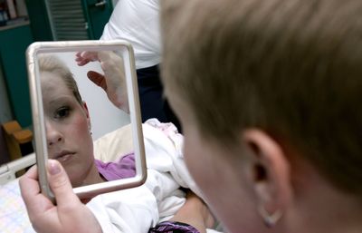 Large BMJ Study Confirms GLP-1 Drugs Like Ozempic and Mounjaro Are Linked to a Real Hair Loss Risk