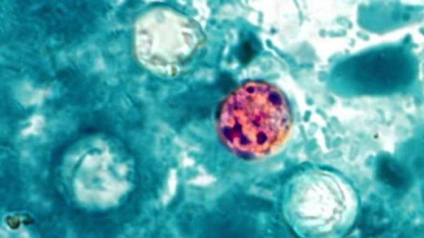 Former top US food safety official says Trump’s handling of cyclospora is ‘catastrophic’