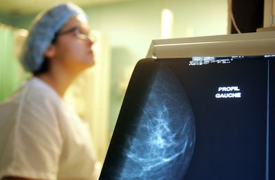 FDA Approves Revtorpyk for a Breast Cancer Subgroup That Had Been Left Out of Targeted Treatment