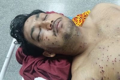 Indian authorities ‘blame single officer’ for use of controversial pellet gun on protesters