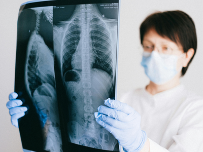 Why some smokers don't develop lung cancer, while non-smokers do: New study reveals direct evidence
