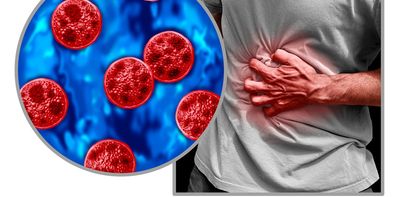 Cyclosporiasis sickens some people worse – why your diarrhea could be more explosive than others