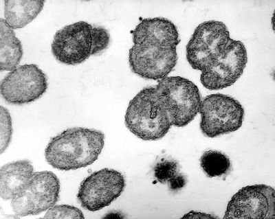 CDC Documents an Increase in Severe Bloodstream Gonorrhea Infections in Alaska Across Two Surveillance Years