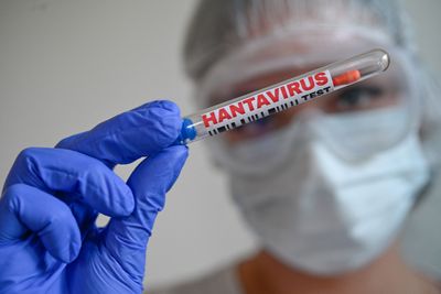 Hantavirus Can Affect the Brain and Nerves in Rare Cases, a New Review of the Literature Finds