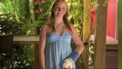 A 13-year-old Texas girl was bitten by a barracuda in Turks and Caicos; after a tourniquet and tendon damage, she still plans to become a marine biologist