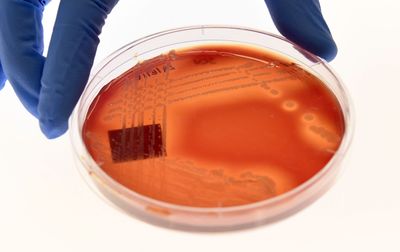 Colorado Reports More Than 250 Salmonella Cases in July, Over 100 Above Its Usual Count