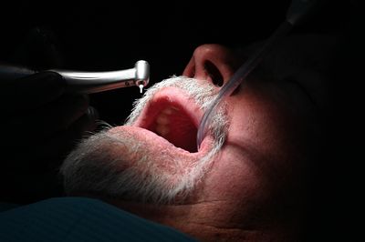 The Enamel-Regrowing Gel in Your Feed Was Tested on Extracted Teeth, Not in Anyone's Mouth