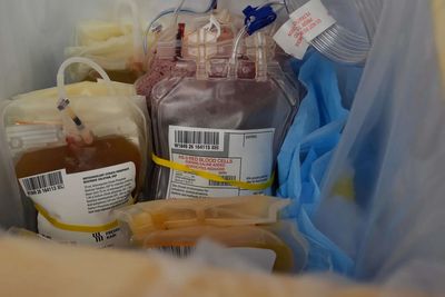 Canada's blood supply drops 20% as Canadian Blood Services issues urgent donation appeal ahead of August long weekend. Here's what's happening