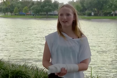 Rare barracuda attack on Caribbean vacation leaves Texas teen in need of surgery