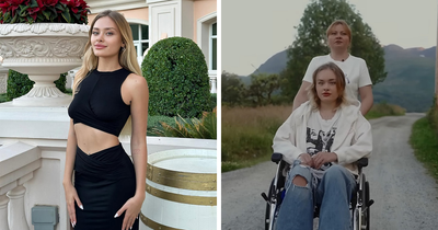 She Dreamed Of Becoming A Famous Model, Until Men At A Party Left Her Fighting For Her Life