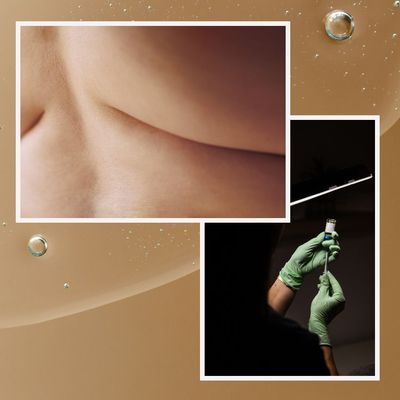 DIY Liposuction Is Trending and Plastic Surgeons Are Not Amused