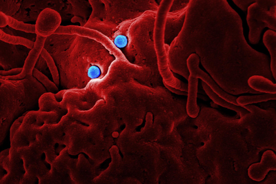 'Explosive Diarrhoea' Parasite Warning Issued to UK Tourists After Mexico Cases Surge