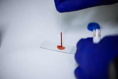 FDA Renamed and Updated Its Companion Diagnostics List, Including the First Test That Detects Cancer's Return in Blood