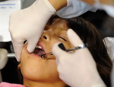 Parents Told a Toddler Needs Fillings Under Anesthesia Now Have Trial Evidence for a Drill-Free Option