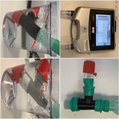 FDA Issues Early Alert on ResMed Astral Ventilators as Replacement Parts Run Short