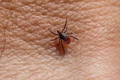 CDC Data Now Show 3,586 Babesiosis Cases in a Single Year as the 2026 Tick Season Peaks