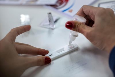 Brazil’s HIV advocates say they predicted USAID funding cuts: ‘We would see the trends’