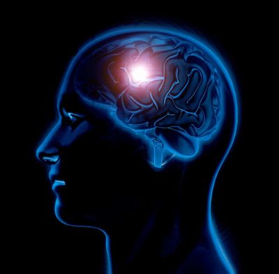 6 Simple Changes That May Protect Your Brain From Stroke